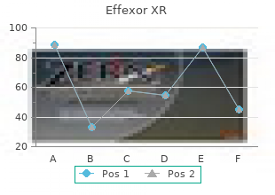 discount effexor xr 150 mg online