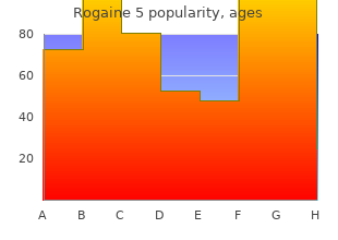 rogaine 5 60 ml for sale