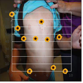 Chromosome 2, monosomy 2p22