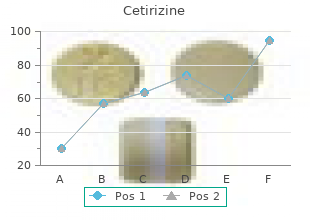 order cetirizine 10 mg with visa