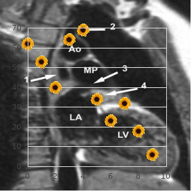 Marshall syndrome