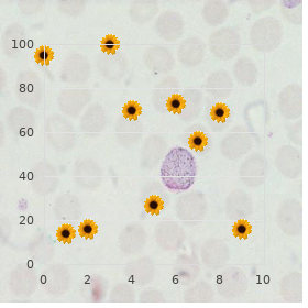 Gangliosidosis (Type2)(GM2)