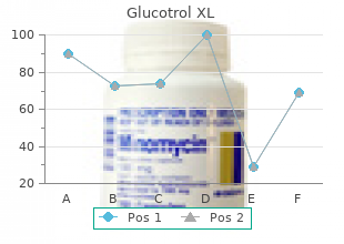 glucotrol xl 10 mg on line