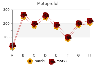 order cheap metoprolol line