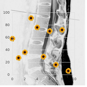 Hyperthermia induced defects