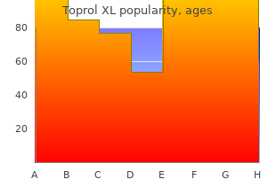 order 25 mg toprol xl with amex