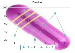 buy 150 mg zantac fast delivery