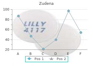 order zudena with paypal
