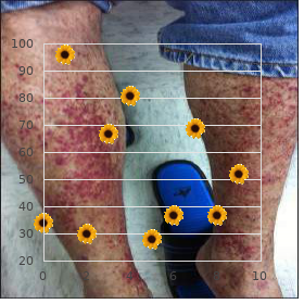 Wrinkly skin syndrome