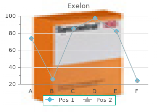 buy exelon 3mg mastercard