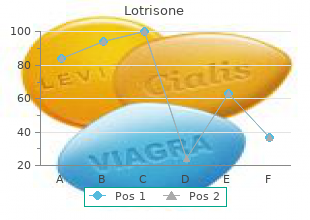 purchase online lotrisone
