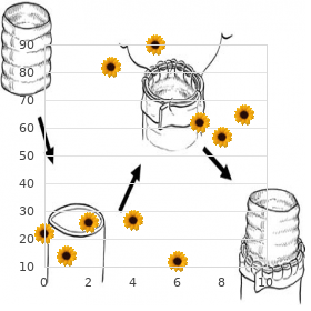 Hexosaminidases A and B deficiency