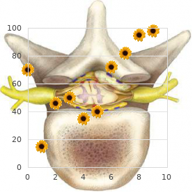 Anophthalmia esophageal atresia cryptorchidism