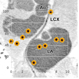 Polymyositis