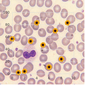 Montefiore syndrome