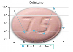 order on line cetirizine