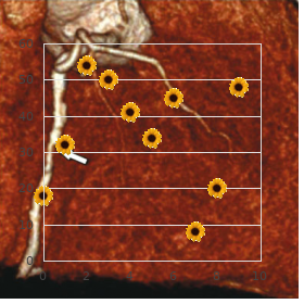 Glaucoma, hereditary adult type 1A