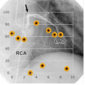 Tracheobronchomalacia