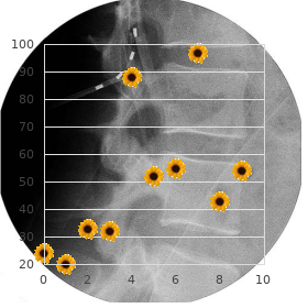 Spinal cord neoplasm