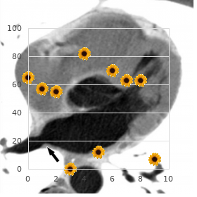 Hydrocephalus growth retardation skeletal anomalies