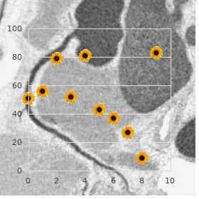 Cardioauditory syndrome