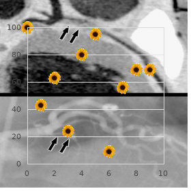 Hirschsprung disease ganglioneuroblastoma