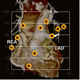 Spastic paraplegia type 6, dominant