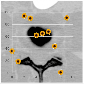 Myopia, severe