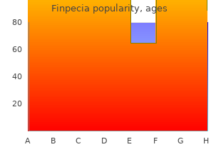 cheap finpecia 1 mg line