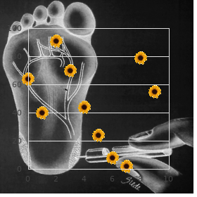 Benign autosomal dominant myopathy