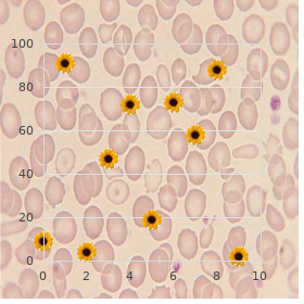 Hypophosphatasia, infantile