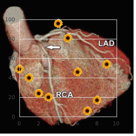 Growth retardation mental retardation phalangeal hypoplasia