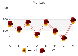 purchase mentax 15mg amex