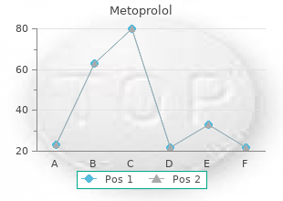 generic 100mg metoprolol with amex