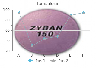 discount tamsulosin 0.4mg mastercard