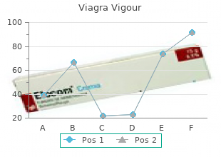 cheapest viagra vigour