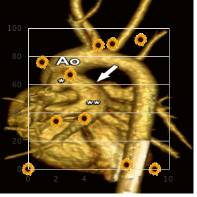 Pseudo-Gaucher disease