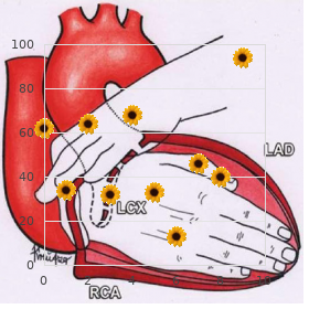 Rapp Hodgkin syndrome