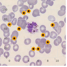 Mixed connective tissue disease