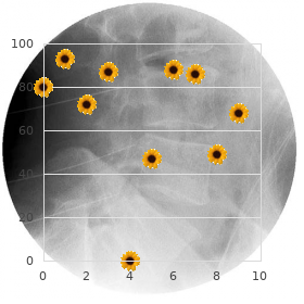 Bone development disorder