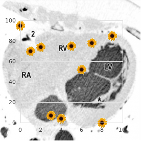 Intestinal atresia multiple