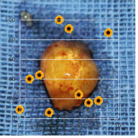 Carcinoma, squamous cell of head and neck