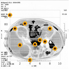 Short stature microcephaly seizures deafness