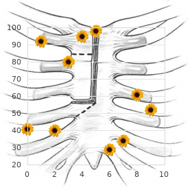 Czeizel Losonci syndrome