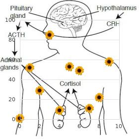 Hydrocephalus costovertebral dysplasia Sprengel anomaly