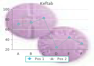 cheap keftab 750mg line