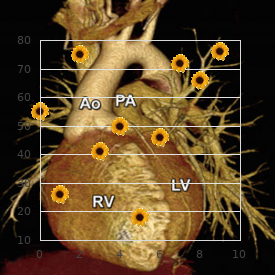 Microcephaly deafness syndrome