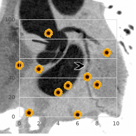 Carnevale Canun Mendoza syndrome