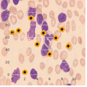 Gangliosidosis (Type2)(GM2)