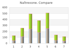 discount naltrexone 50 mg free shipping